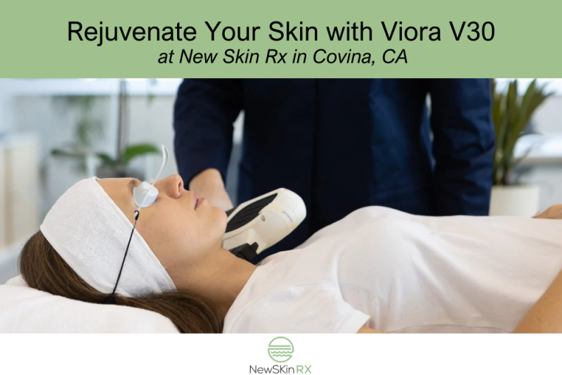 Rejuvenate Your Skin with Viora V30 at New Skin Rx in Covina, CA