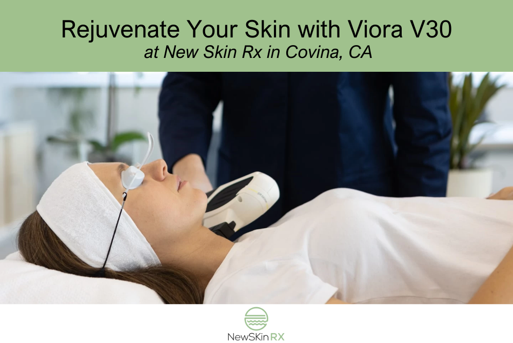Rejuvenate Your Skin with Viora V30 at New Skin Rx in Covina, CA