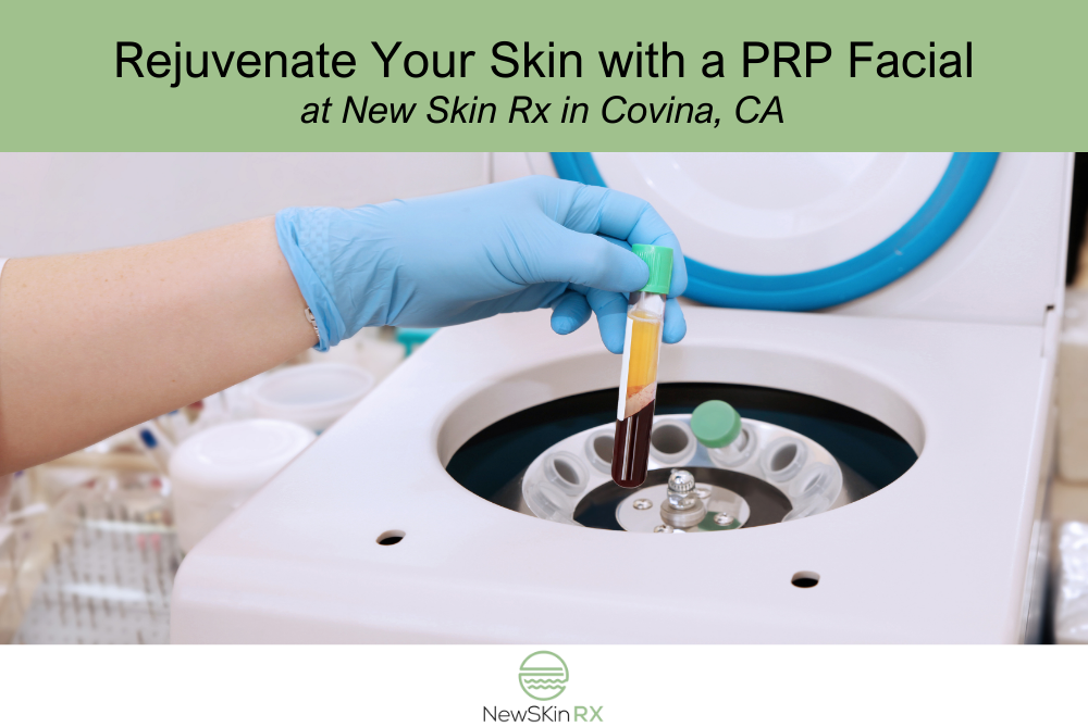 Rejuvenate Your Skin with a PRP Facial at New Skin Rx